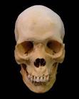 Head 1